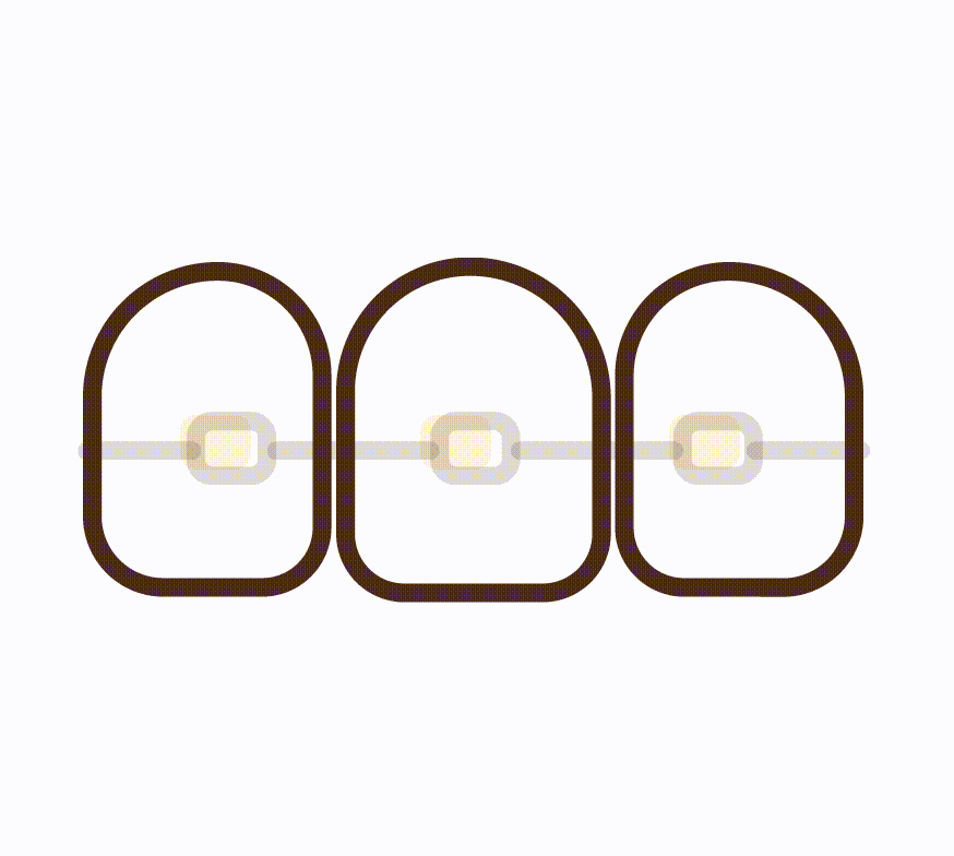 Dental Braces & Aligners